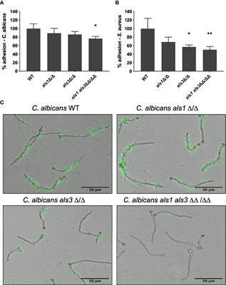 Adhesion of Staphylococcus aureus to Candida albicans During Co-Infection Promotes Bacterial Dissemination Through the Host Immune Response